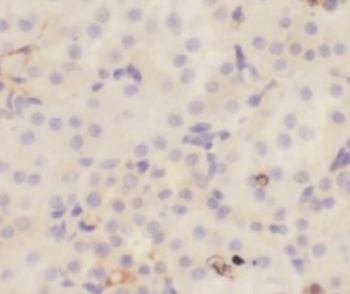 RAB9A Specific Rabbit Polyclonal Antibody