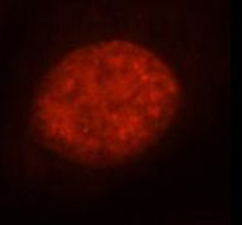 RBM15 Mouse Monoclonal Antibody