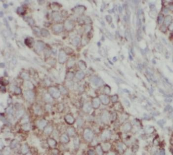 DDIT4 specific Rabbit Polyclonal Antibody