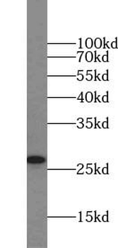 ARHGDIA Rabbit Polyclonal Antibody