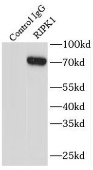 RIPK1 Specific Rabbit Polyclonal Antibody
