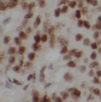 POLR2E Antibody