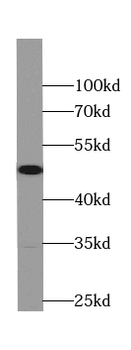 RPL3 Mouse Monoclonal Antibody