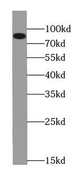 RRM1 Specific Rabbit Polyclonal Antibody