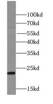 RTN1 C Rabbit Polyclonal Antibody