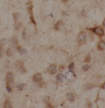RTN1 C Rabbit Polyclonal Antibody