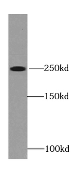 RYR2 Rabbit Polyclonal Antibody