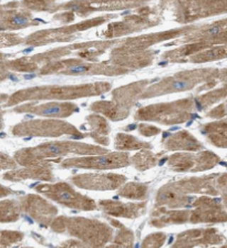 RYR2 Rabbit Polyclonal Antibody