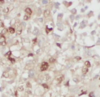S100A11 Mouse Monoclonal Antibody