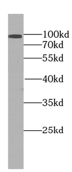 EXOC2 Rabbit Polyclonal Antibody
