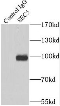 EXOC2 Rabbit Polyclonal Antibody