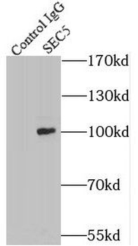 EXOC2 Mouse Monoclonal Antibody