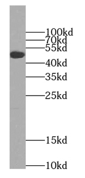 SEC61A1 Rabbit Polyclonal Antibody