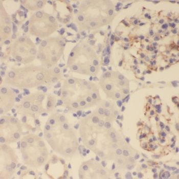 SEC61A1 Rabbit Polyclonal Antibody