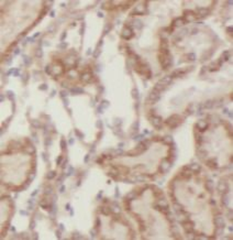 SEMG1 Rabbit Polyclonal Antibody