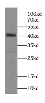 SEPTIN1 Rabbit Polyclonal Antibody