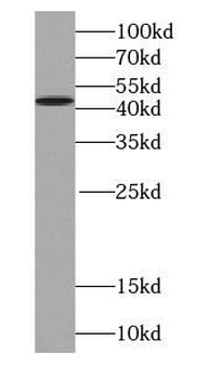SEPTIN2 Mouse Monoclonal Antibody