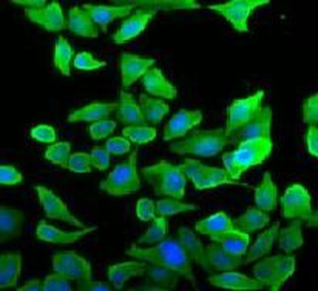 SEPTIN2 Mouse Monoclonal Antibody