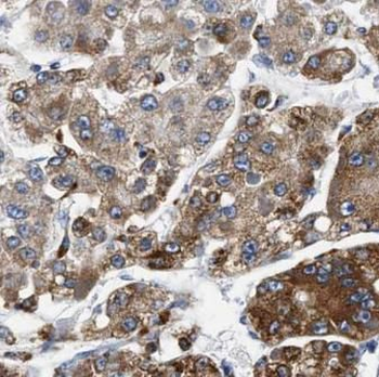 SEPTIN2 Mouse Monoclonal Antibody