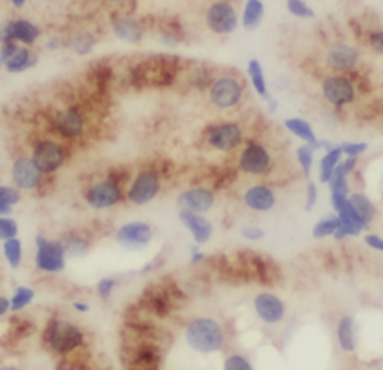 MSRB1 Rabbit Polyclonal Antibody