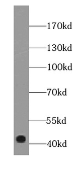 SIRPB1 Rabbit Polyclonal Antibody