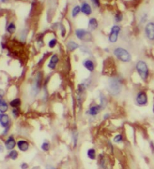 SIRPB1 Rabbit Polyclonal Antibody