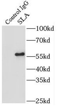 SEPSECS Rabbit Polyclonal Antibody