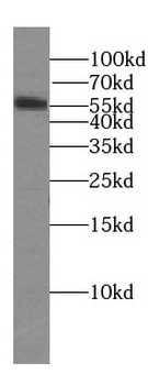 SMYD1 Antibody