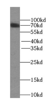 SLC5A5 Antibody