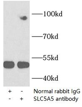 SLC5A5 Antibody