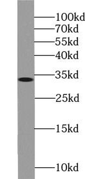 STC2 Antibody
