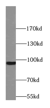 STT3B Rabbit Polyclonal Antibody