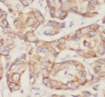 SUMF2 Rabbit Polyclonal Antibody