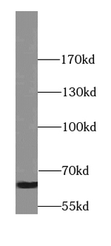 SYT3 Rabbit Polyclonal Antibody