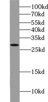 STX6 Mouse Monoclonal Antibody