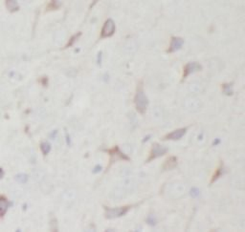 STX6 Mouse Monoclonal Antibody