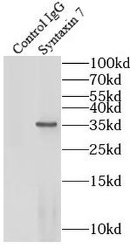 STX7 Rabbit Polyclonal Antibody