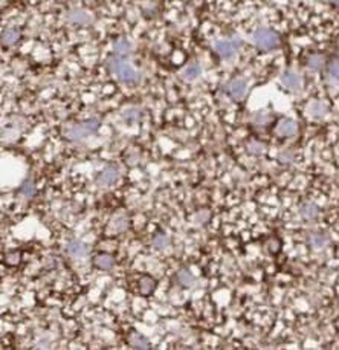 STX7 Rabbit Polyclonal Antibody