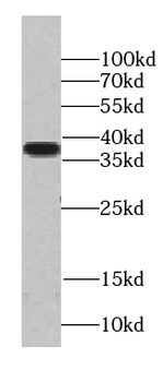 TADA1 Rabbit Polyclonal Antibody