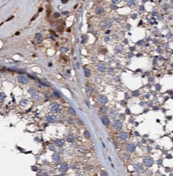 TADA1 Rabbit Polyclonal Antibody
