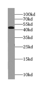 TAF1 Specific Rabbit Polyclonal Antibody
