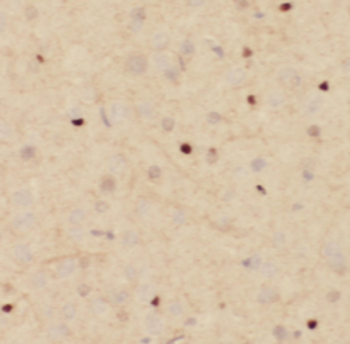 TAF1 Specific Rabbit Polyclonal Antibody