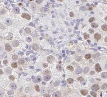 TDRKH specific Rabbit Polyclonal Antibody
