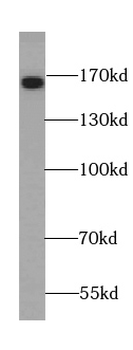 TNR Antibody