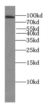 TFIP11 Antibody