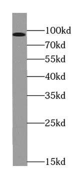 TGFBR3 Specific Rabbit Polyclonal Antibody