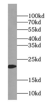 TIMM23 Rabbit Polyclonal Antibody