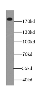 TOP2A Specific Rabbit Polyclonal Antibody