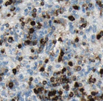 TOP2A Specific Rabbit Polyclonal Antibody