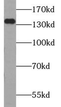 TPP2 Rabbit Polyclonal Antibody